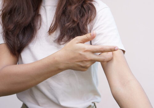 Itching when applying DeoAce? What Causes It and What to Do About It